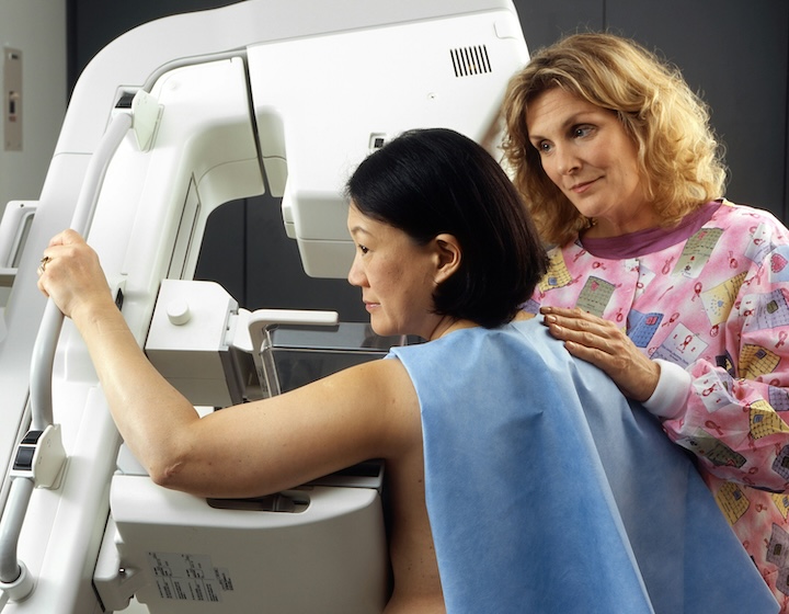 mammogram screening